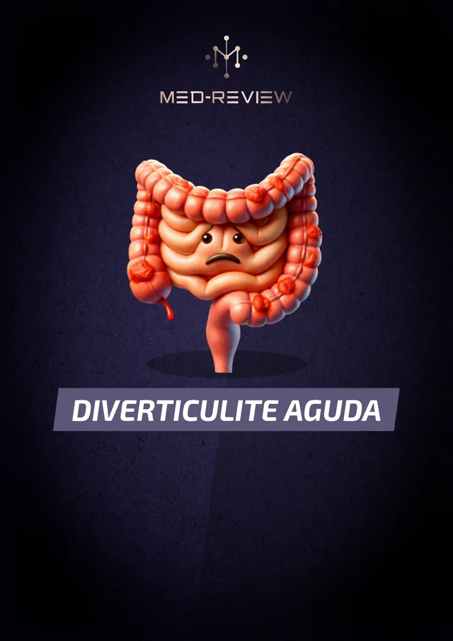 Capa do material Diverticulite aguda do cólon