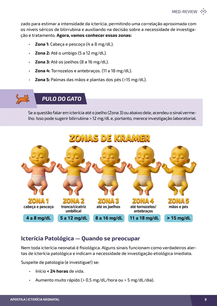 Página interna da apostila sobre Icterícia neonatal: zonas de Kramer, hemólise e fototerapia