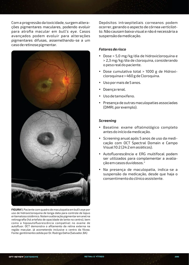 Página interna da apostila sobre Albinismo ocular, toxicidade retiniana por drogas e retinopatias traumáticas