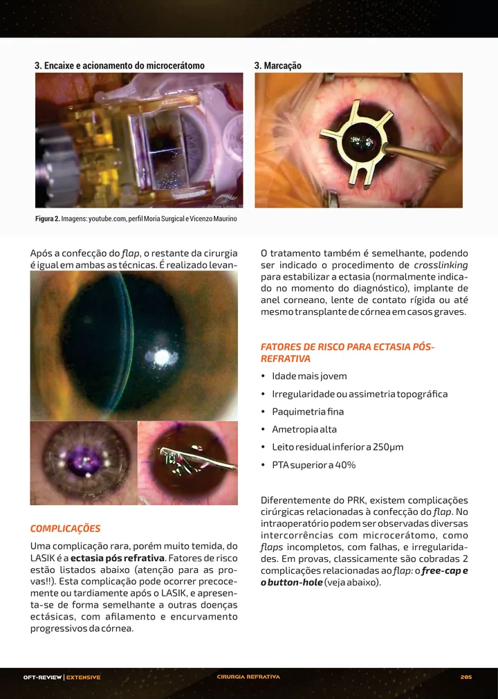 Página interna da apostila sobre Cirurgia refrativa: topografia, seleção, PRK, LASIK, SMILE e lentes fácicas