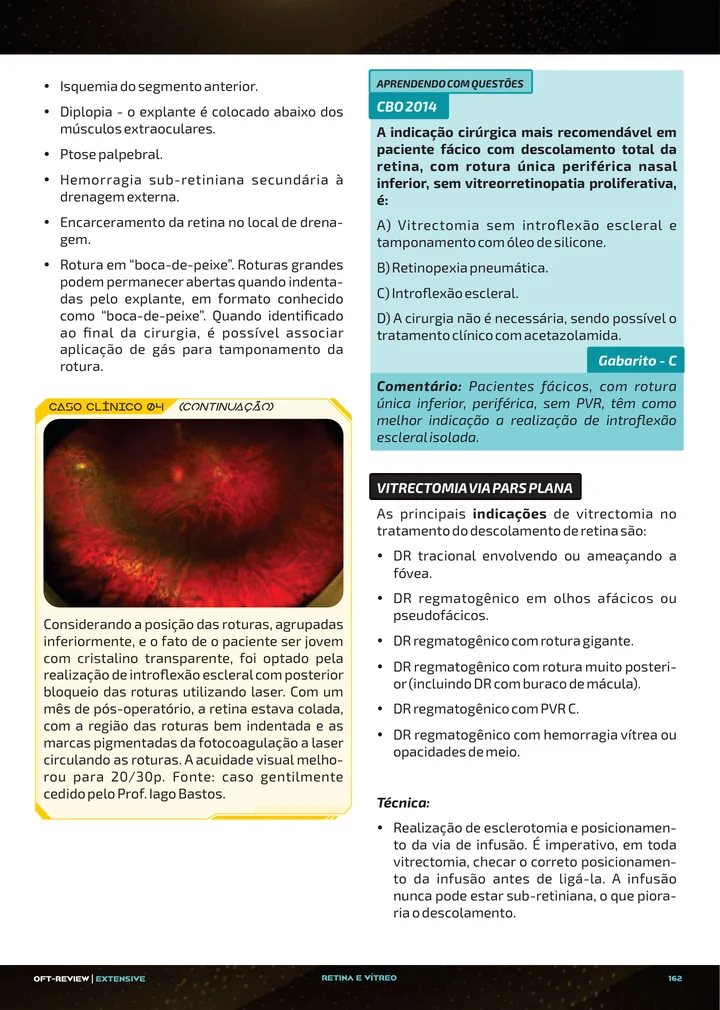 Página interna da apostila sobre Descolamento de retina: tipos, diagnóstico e tratamento cirúrgico