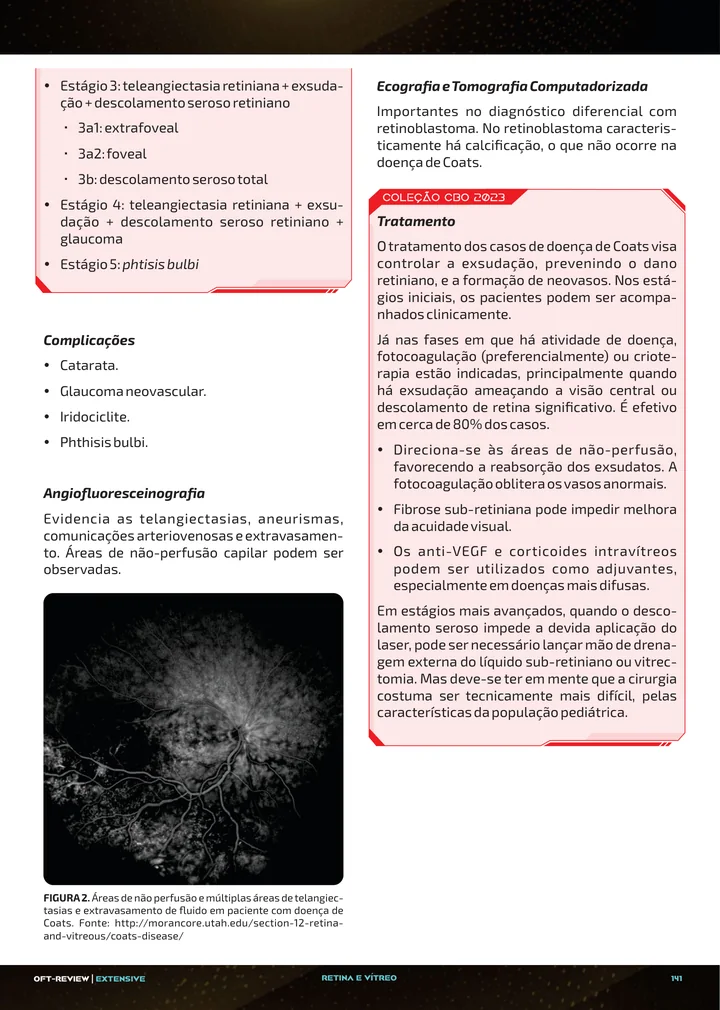 Página interna da apostila sobre Doença de Coats, síndrome de Terson e outras doenças vasculares da retina