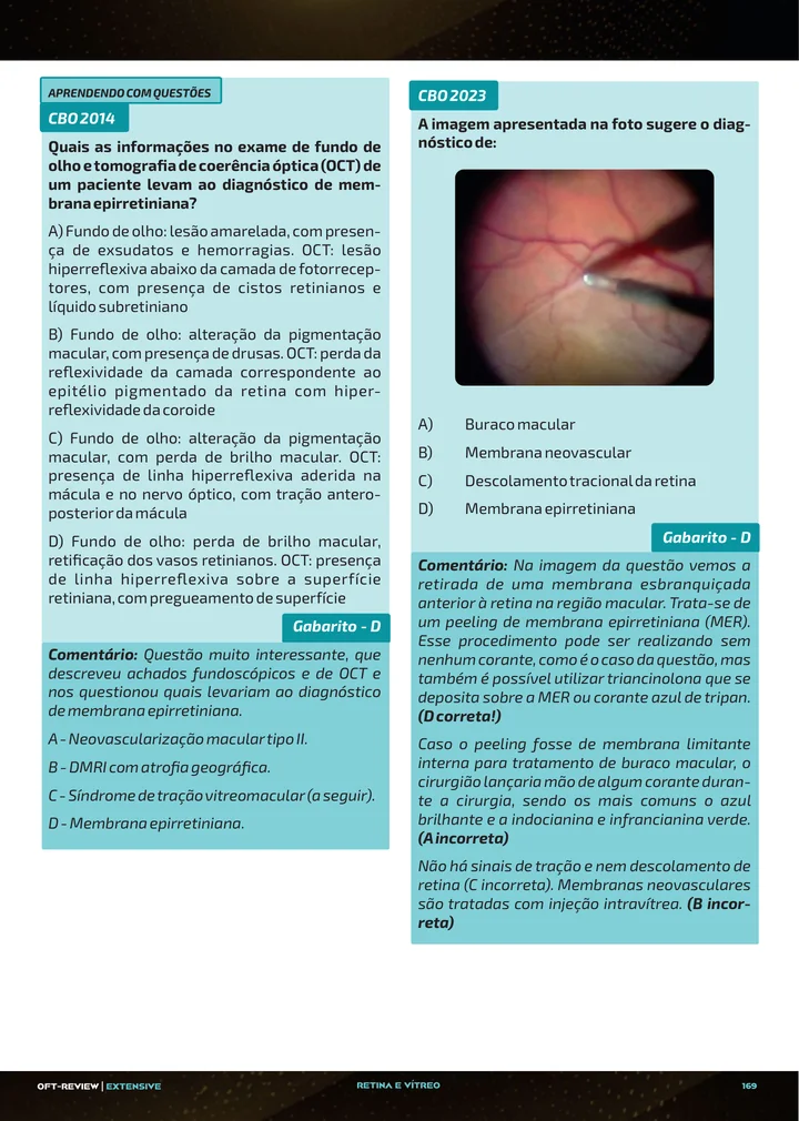 Página interna da apostila sobre Membrana epirretiniana, tração vitreomacular e buraco macular