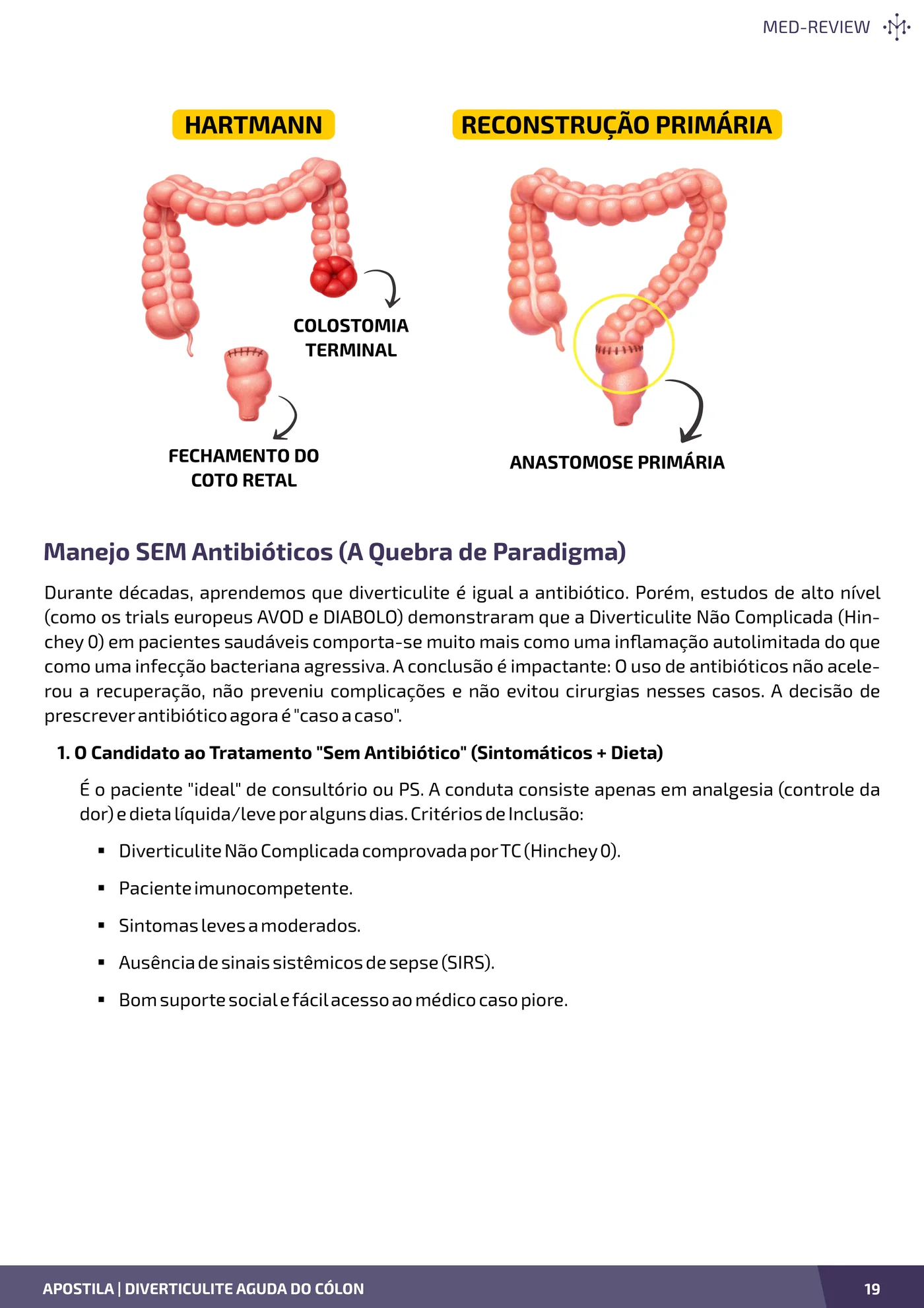 Página da apostila Diverticulite aguda do cólon