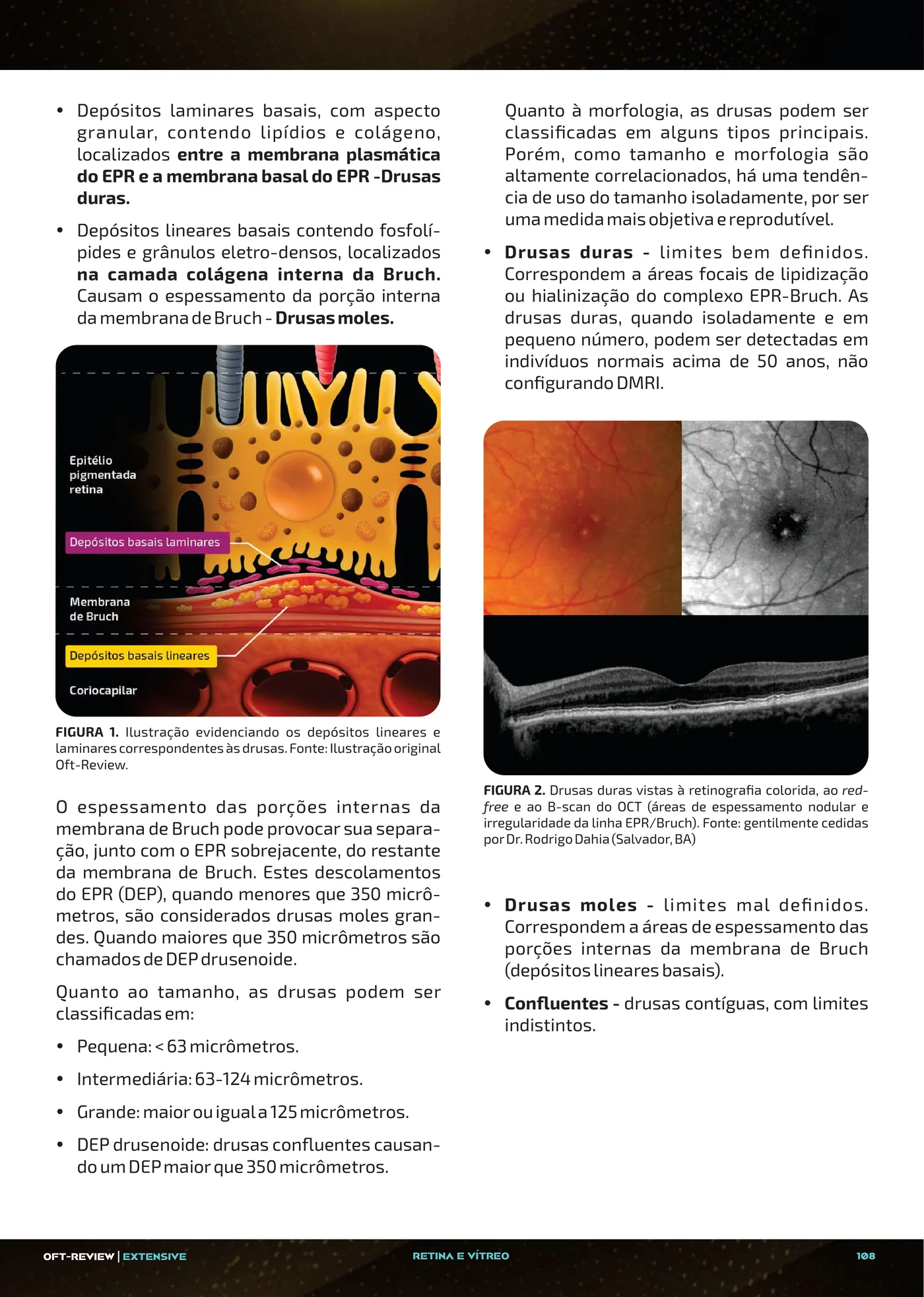 Página da apostila DMRI: degeneração macular relacionada à idade