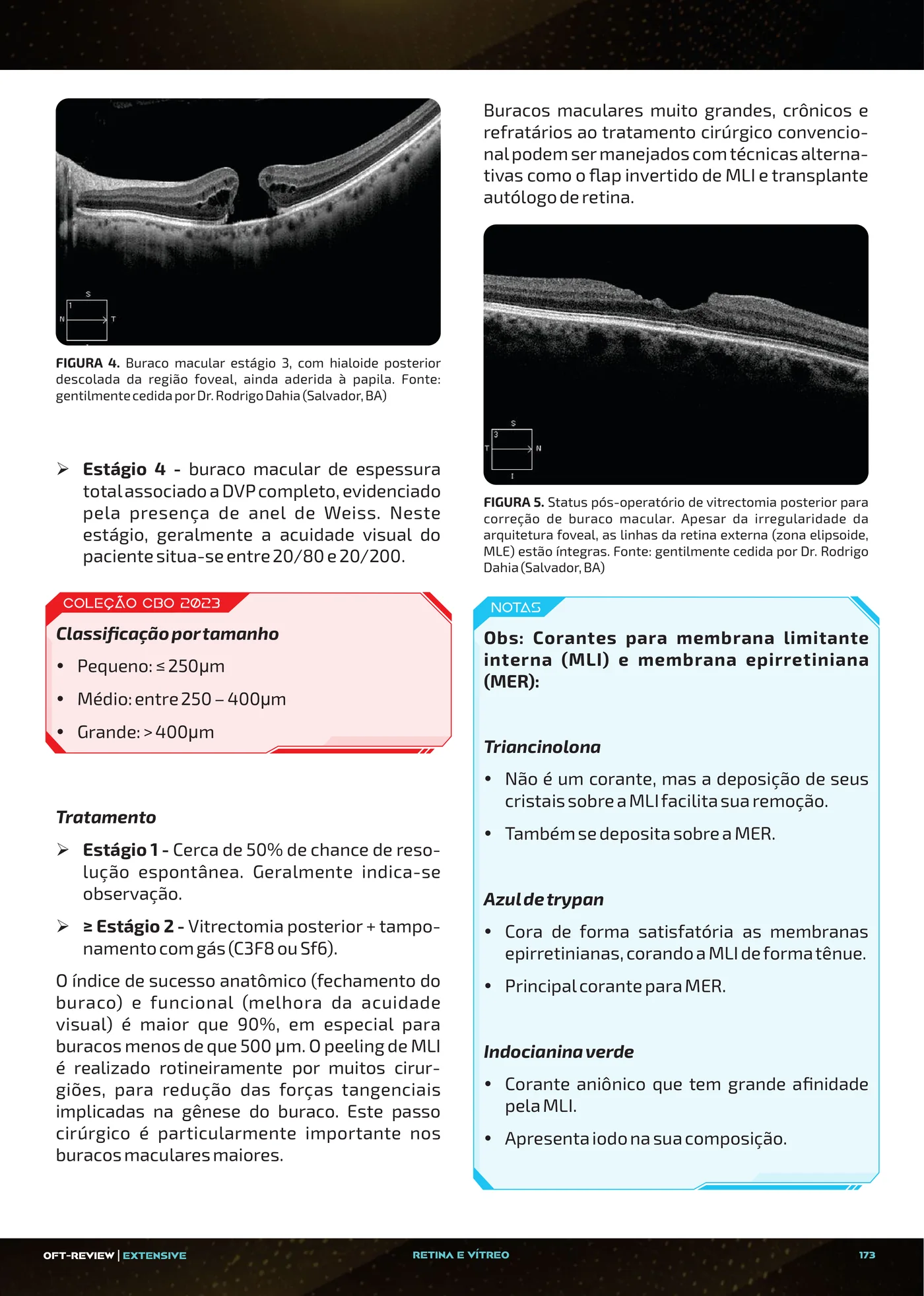 Página da apostila Membrana epirretiniana, tração vitreomacular e buraco macular