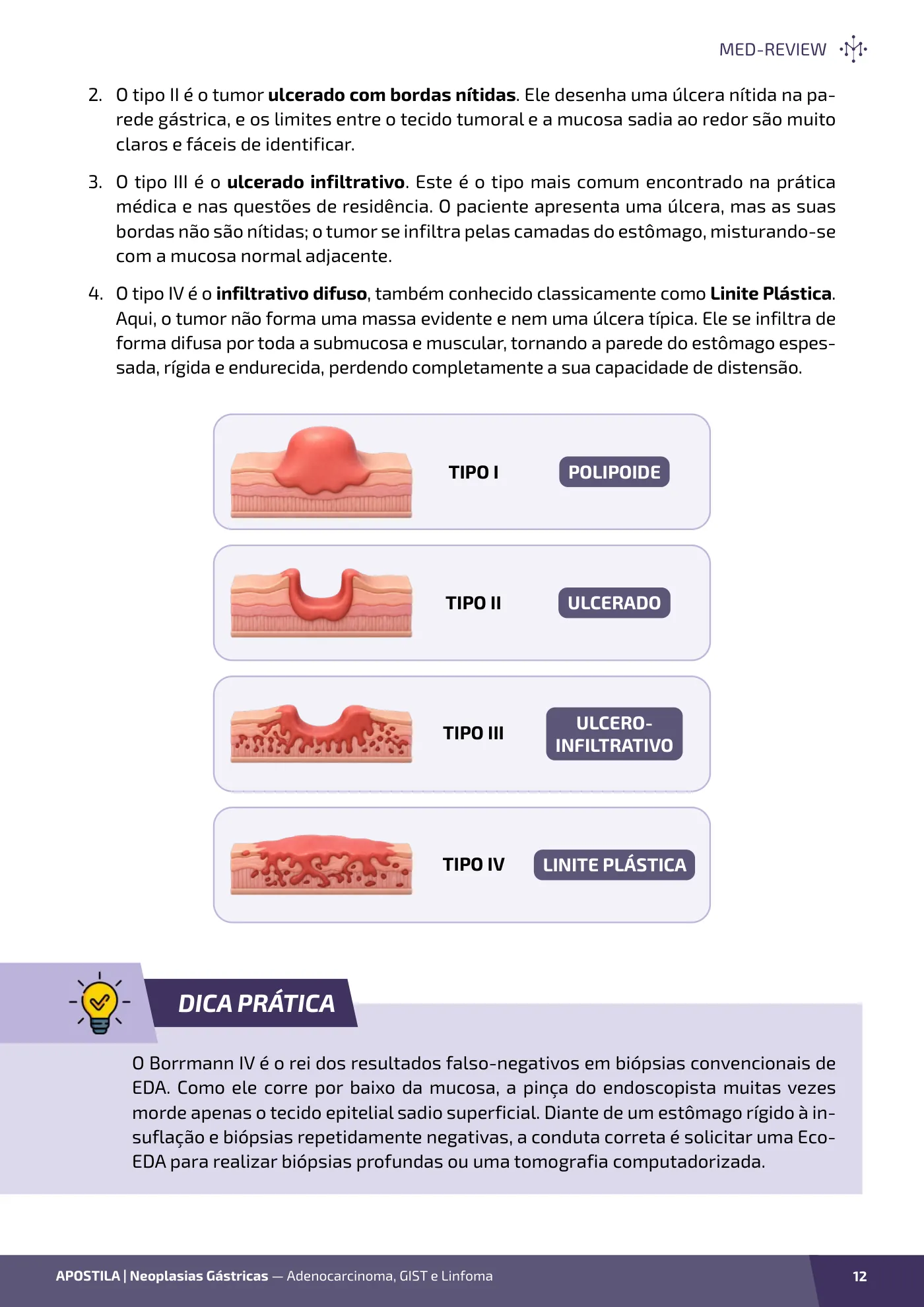 Página da apostila Neoplasias gástricas: adenocarcinoma, GIST e linfoma