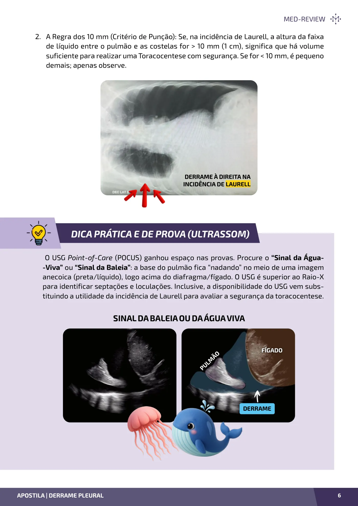 Página da apostila Derrame pleural: do diagnóstico à drenagem