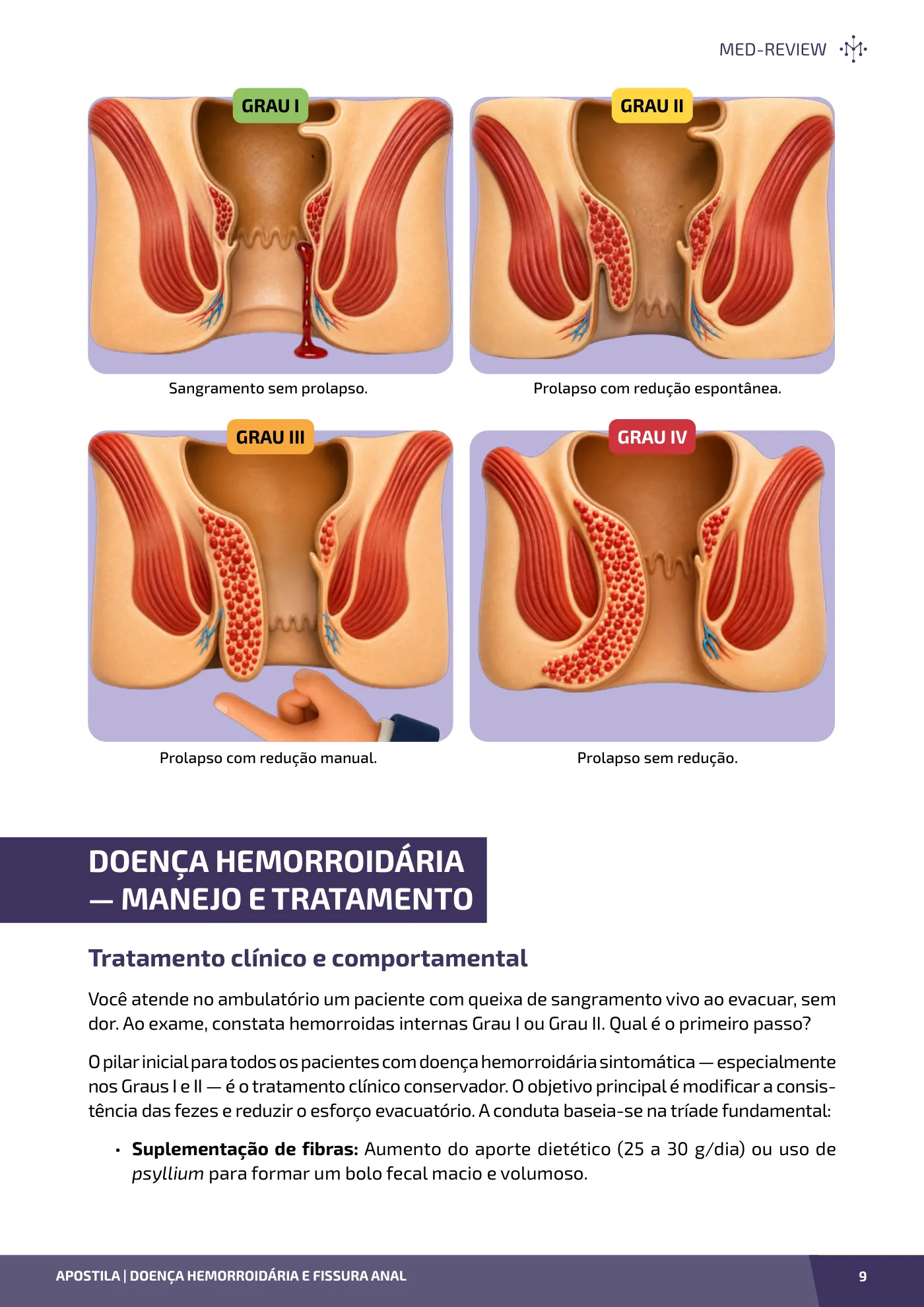 Página da apostila Doença hemorroidária e fissura anal