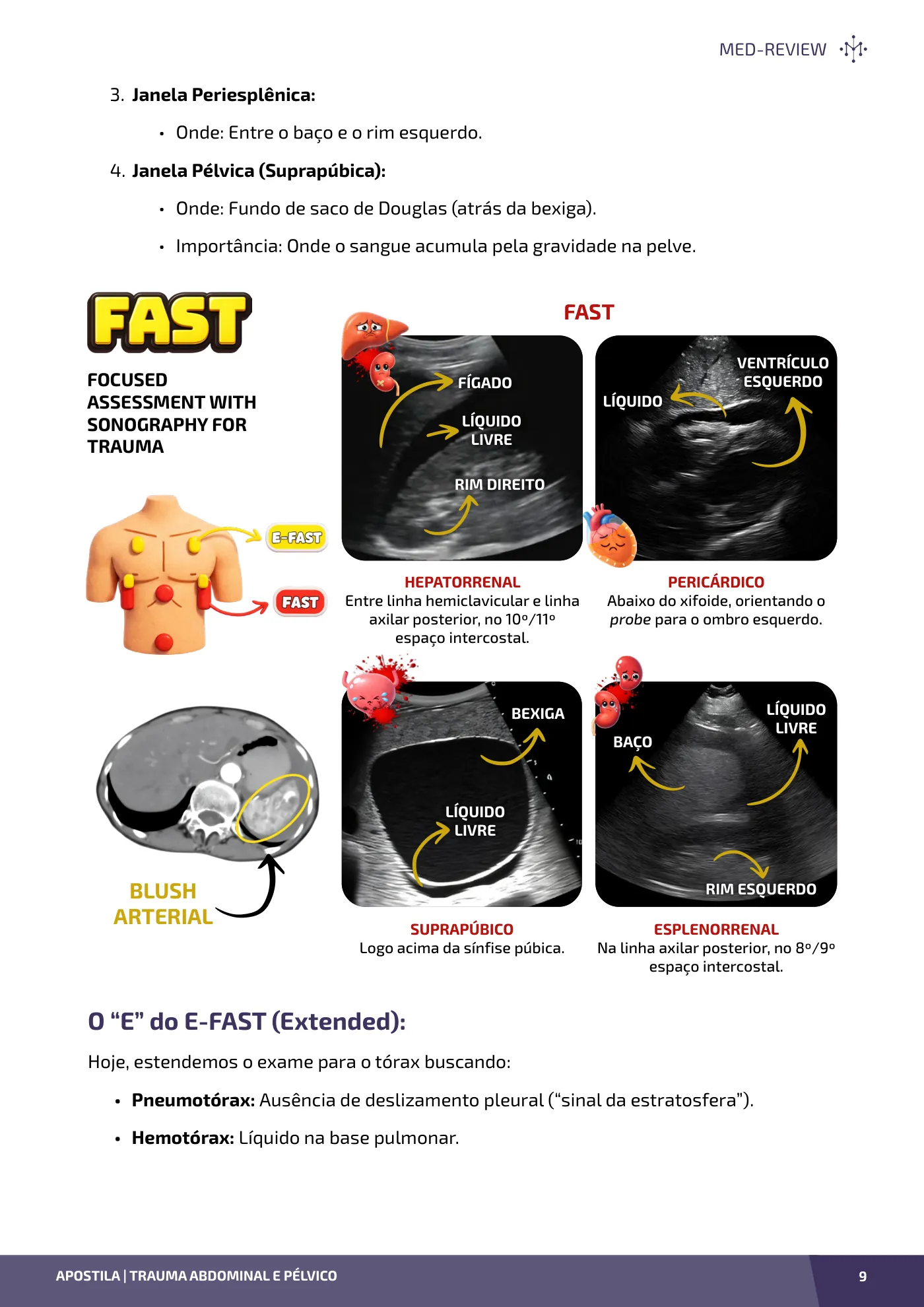 Página da apostila Trauma abdominal e pélvico: FAST, tratamento não operatório e controle de danos